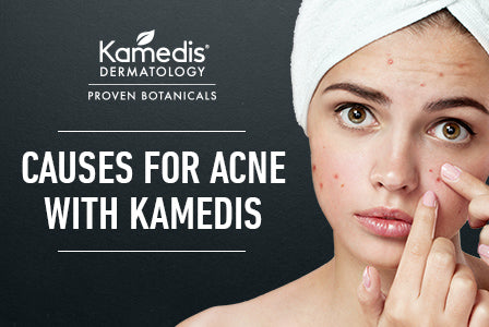 What Caused My Acne?