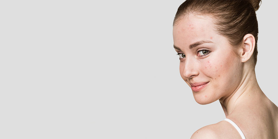 How to Take Care of Your Skin During the Summer (2021 Edition)