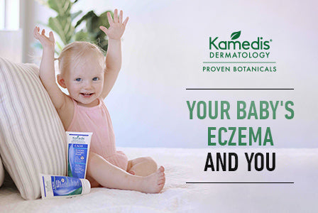 Baby Eczema