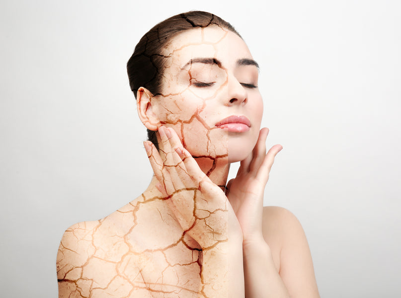 How to Deal with Dry Skin and Eczema in the Winter?