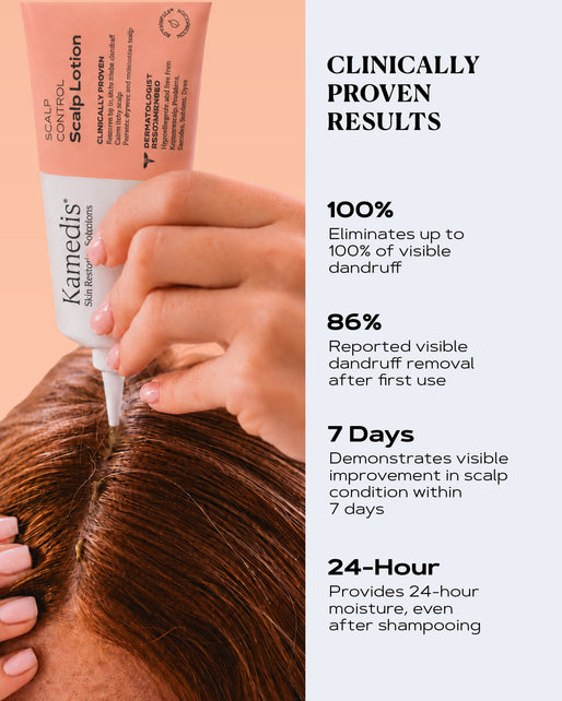 Pre-Shampoo Scalp Lotion | SCALP CONTROL