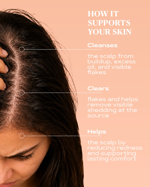 OTC Anti-Dandruff Shampoo | SCALP CONTROL