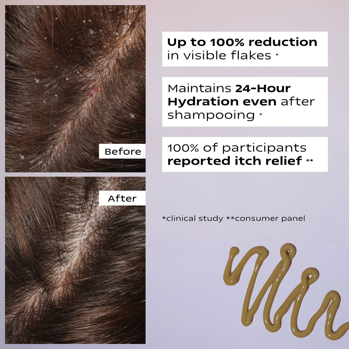 Ultimate Anti Dandruff Kit